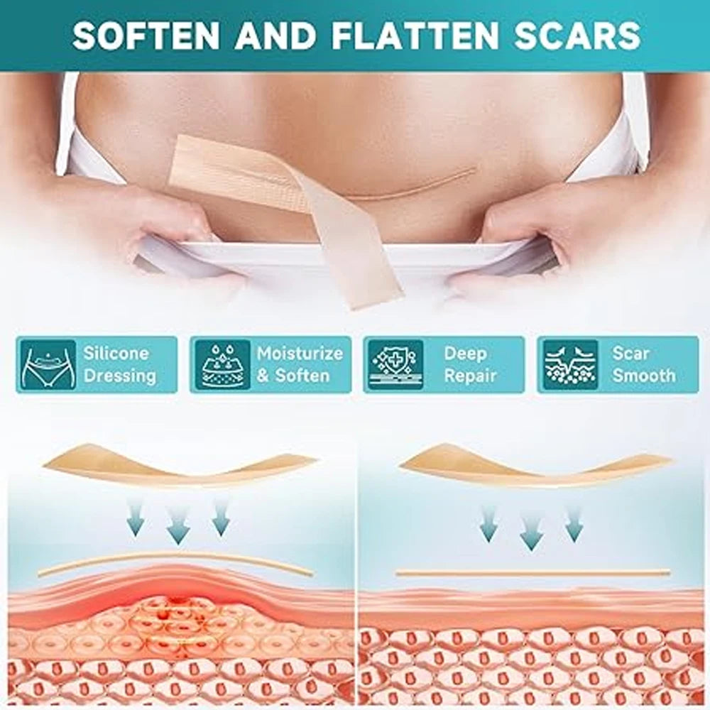 Silicone Skin Care Tape Roll