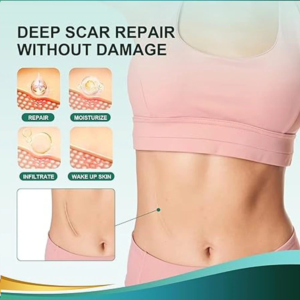 Silicone Skin Care Tape Roll