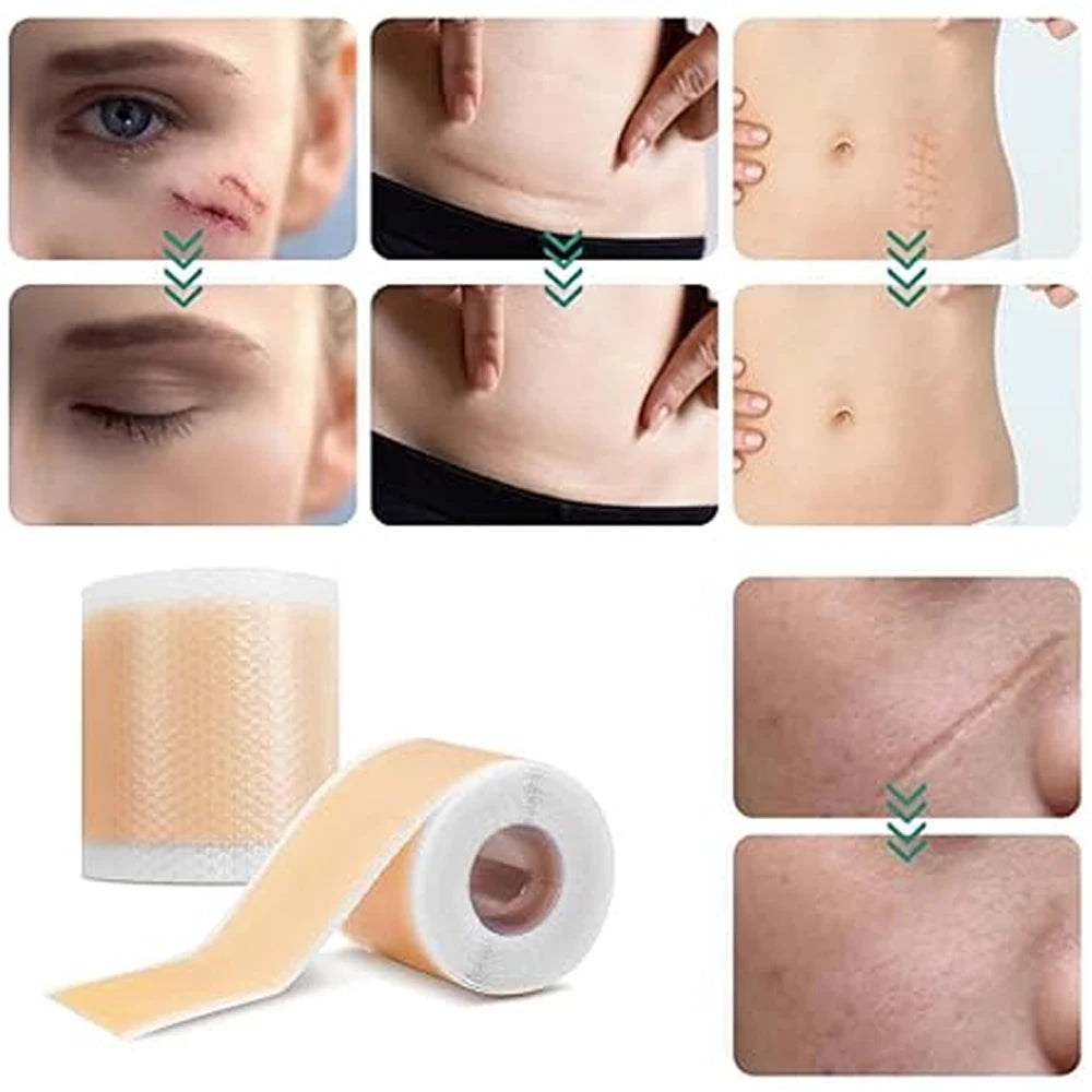 Silicone Skin Care Tape Roll