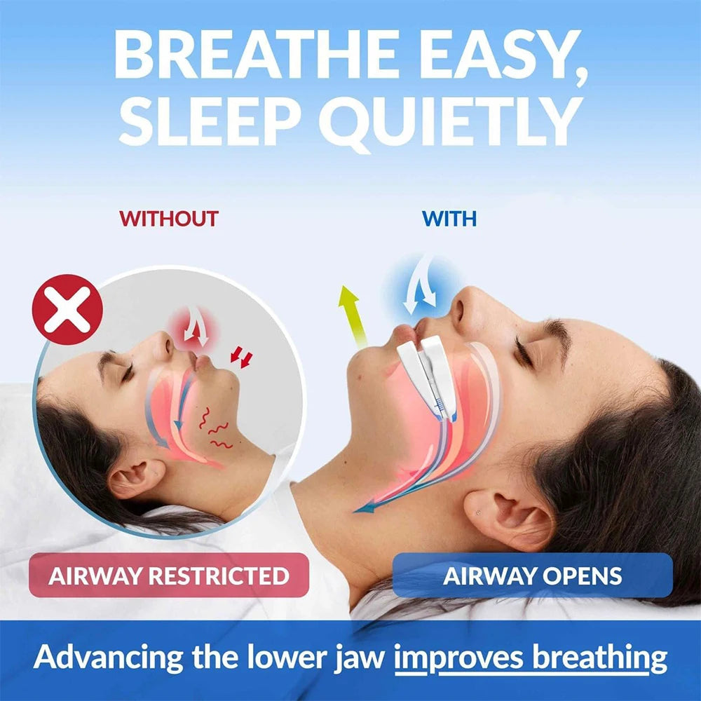 Anti-Snoring Nighttime Mouth Guard